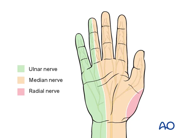 Zenuwen in de hand: nervus medianus, radialis en ulnaris