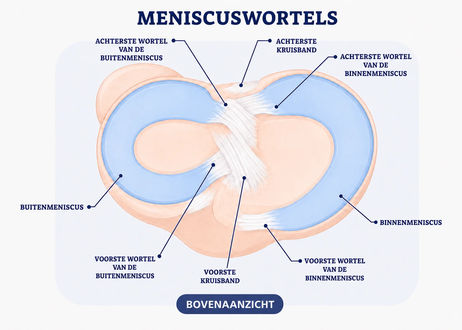 Bovenaanzicht van de binnen- en buitenmeniscus met de voorste en achterste meniscuswortels